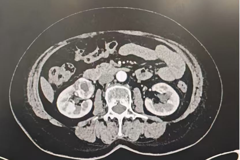 c52c70741a32f364f6fc1ecff8c583a3.png 2.png